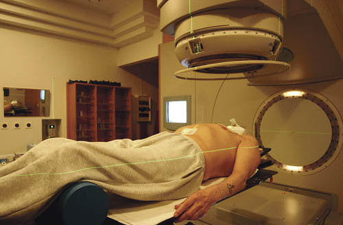 Bestrahlung eines Turmorpatienten, Strahlentherapie - radiotherapy 