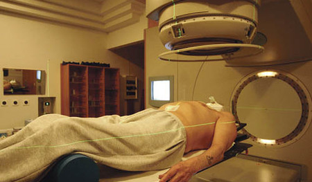 Bestrahlung eines Turmorpatienten, Strahlentherapie - radiotherapy 